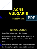 Acne Vulgaris