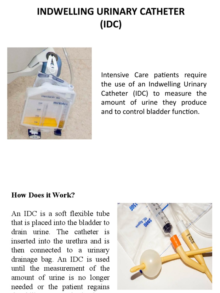 Indwelling Urinary Catheter Idc PDF