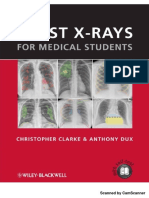 Chest Xrays for Medical Students (Dịch)