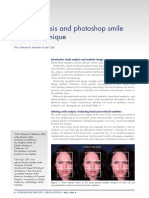 Smile Analysis and Photoshop Smile Design Technique: Clinical