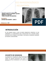 1 B - Neumonia - Grupo 2