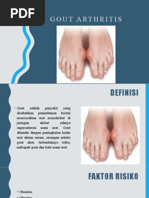 Gout Arthritis Pdf