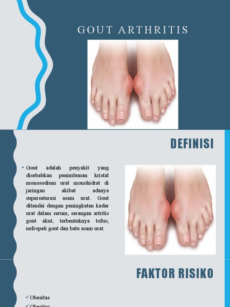 Gout Arthritis Pdf