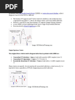 Sgarbossa Criteria Overview