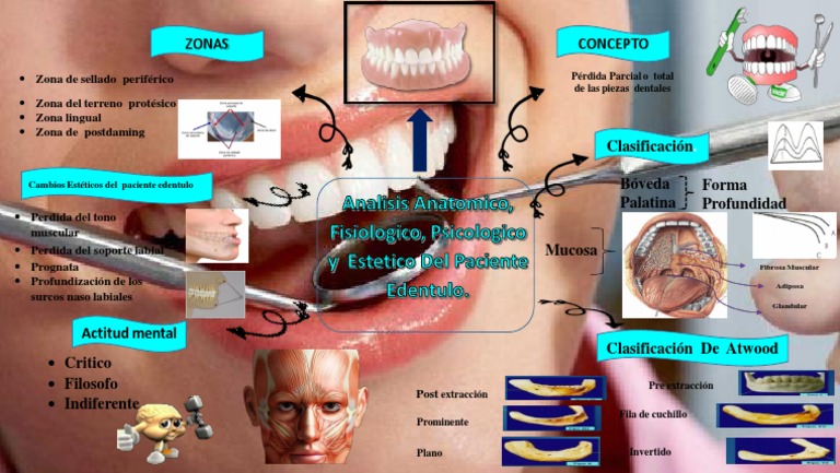 Analisis Anatomico de Paciente Totalmente Edentulo | PDF