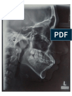 Tracing Sefalometri - Typodont Kasus I - Tiara Bistya Astari