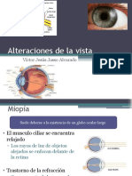 Alteraciones de La Vista