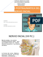 Parálisis Postraumatica Del Nervio Facial
