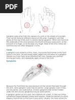 Ganglion Cysts