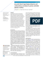 Strawberry Pink Blood: Hypertriglyceridaemia and Diabetic Ketoacidosis Secondary To Poorly Controlled Type 2 Diabetes Mellitus