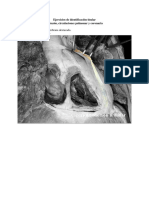 Taller # 38 de Identificación Tisular Corazón, Circulaciones Pulmonar y Coronarias