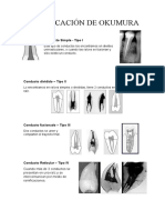 Clasificación de Conductos OKUMURA