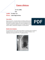 Caso Clínico de Torax