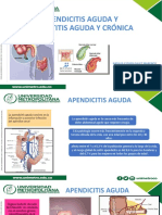 Apendicitis Aguda2