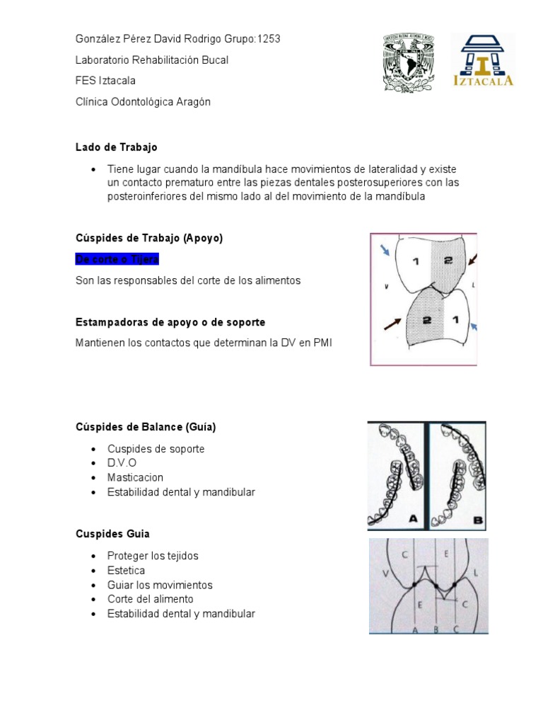 Cúspides de Trabajo Vs Cúspides de