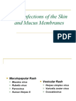 Viral Infections of The Skin and Mucus Membranes