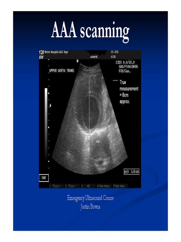 AAA Scanning: Emergency Ultrasound Course Justin Bowra | PDF | Aorta ...