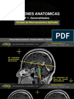 Imágenes Anatómicas RM Encéfalo