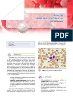 Anemia Mieloptisica Infiltrativa