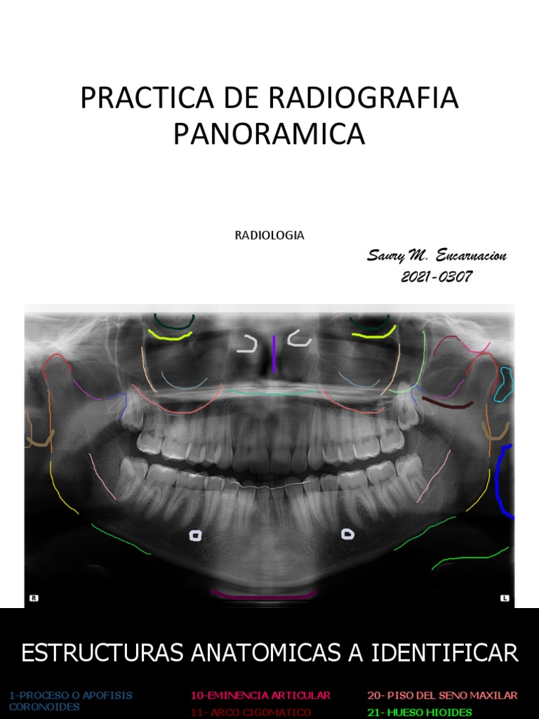 Estructuras en Radiografía Panorámica | PDF