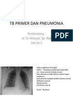 TB Dan Pneumoni 43 S