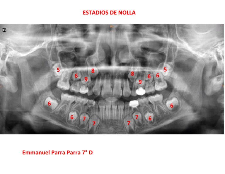 Estadios De Nolla 736x736