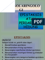 ENT Epistaksis