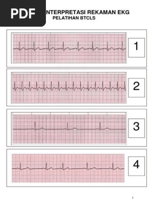 LEMBARAN PENUGASAN Interpretasi Gambaran EKG PDF