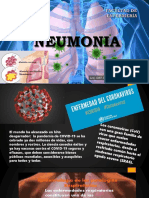 4. neumonia-2020
