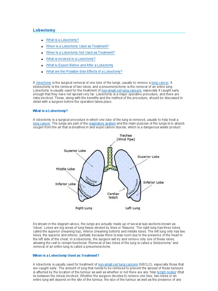 lung cancer s o lobectomy icd 10