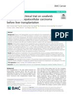 ARTIGO 4 - A Prospective Clinical Trial On Sorafenib Treatment of Hepatocellular Carcinoma Before Liver Transplantation