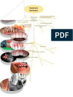 Mapa Mental Exodoncia Quirurgica