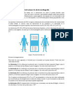 Derivaciones de Electrocardiografía