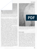 Reet Reserptien: Fig. 13. Paraffin Section of Root With Microorganisms in Necrotic