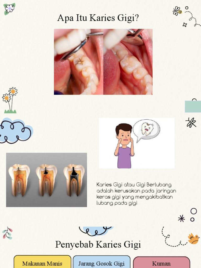 Karies Gigi | PDF | Karier & Perkembangan