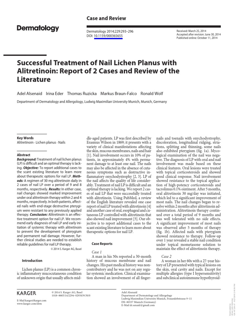 Successful Treatment of Nail Lichen Planus With Alitretinoin PDF