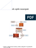 Iskemik Optik Neuropati