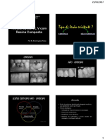 Restaurações CL V - Cópia