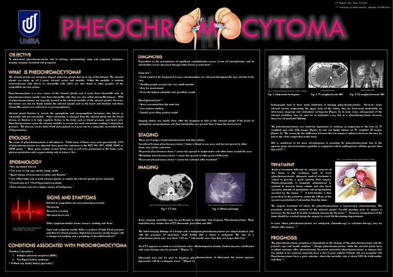 Pheochromocytoma Overview and Insights | PDF | Adrenal Gland | Medical ...
