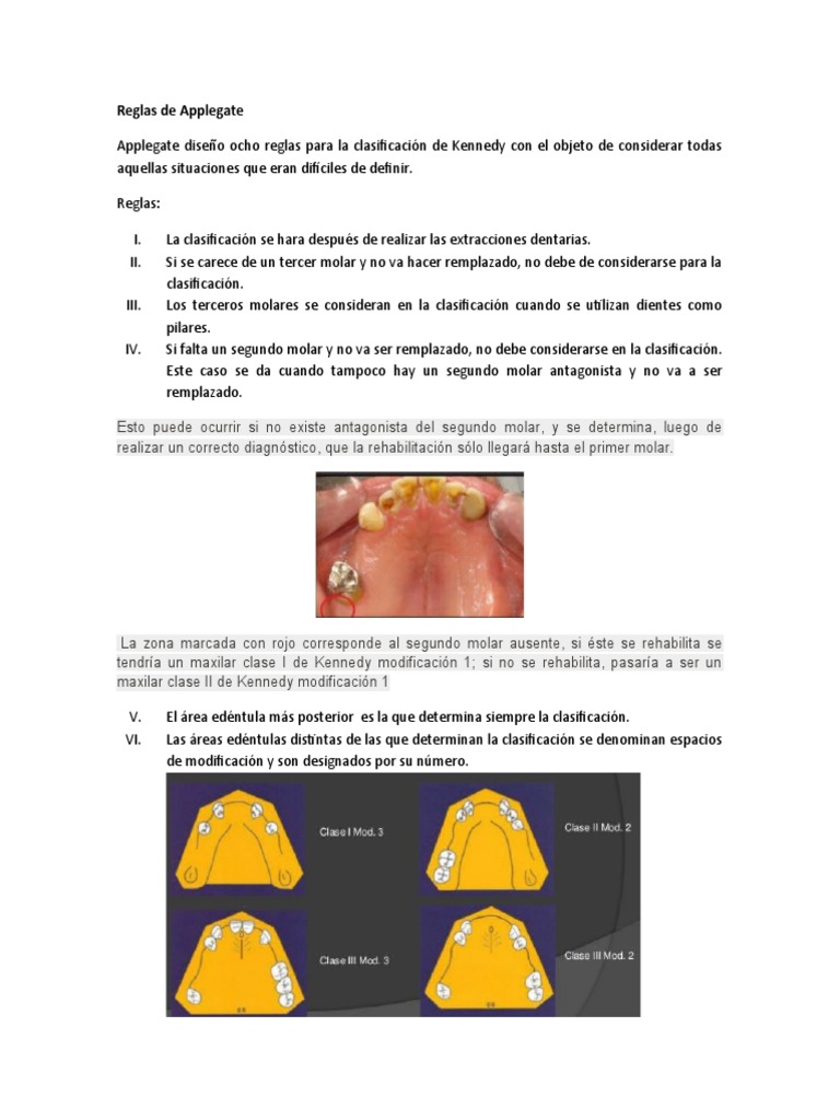 Reglas de Applegate PDF