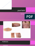 Psoriasis: An Overview of Causes, Types, and Treatments