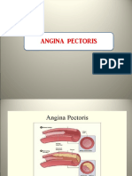 Angina Pectoris