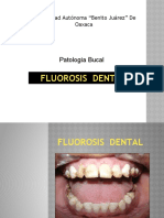 Fluorosis Dental