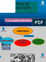 Tipos de anestesia: general, regional y local