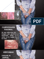 Candidiasis Vaginal