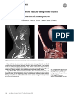 Síndrome Vascular Del Opérculo Torácico