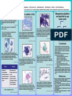 Pitfalls in Diagnosis of Hsil