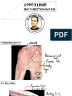 Cadaveric Dissection Images: Upper Limb