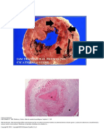 Caso Clinico 1 Necrosis