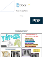Radiologia Torax Downloable